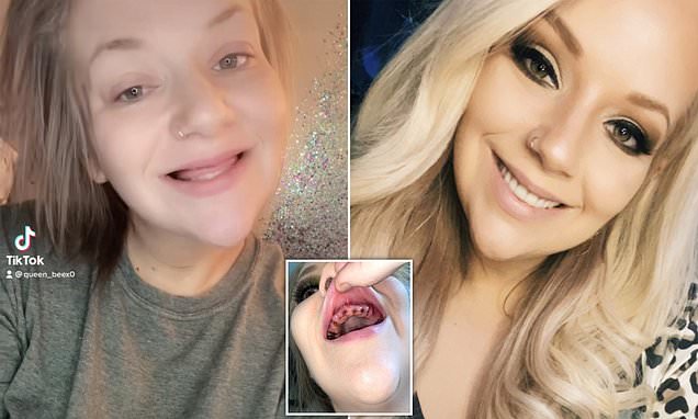 Woman whose ill health caused her to lose her teeth and suffer hair loss looks unrecognizable [Video]