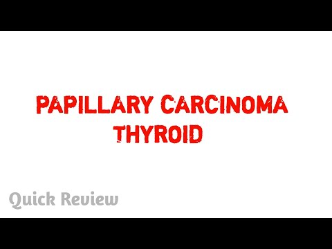 Thyroid cancers – Pathology || Easy explaination || MBBS [Video]