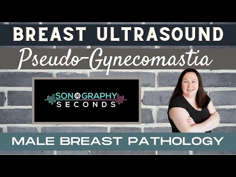 Breast Ultrasound- Male Breast Pathology (Pseudo-Gynecomastia) [Video]