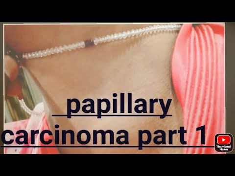 thyroid cancer part 1 [Video]