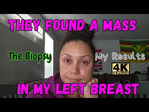 They Found A Mass In My Left Breast | My Biopsy | The Results | [Video]
