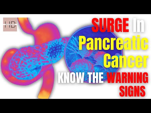 PROTECT Your Family From The Growing THREAT of Pancreatic CANCER | Know The WARNING Symptoms [Video]