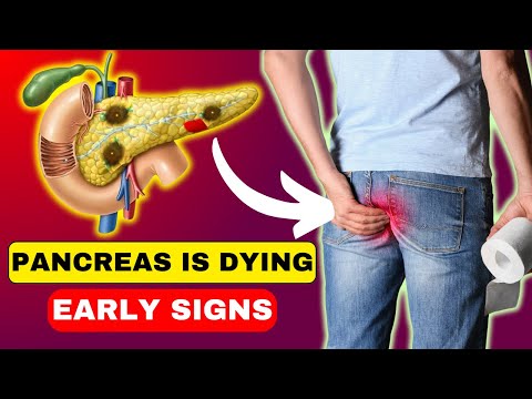 The 10 Signs of Pancreatic Disease | Pancreatic Issues [Video]