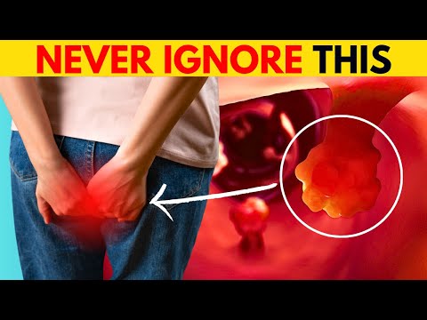 7 Signs and Symptoms Of Colon Cancer (MUST WATCH) [Video]
