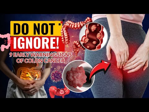 Don’t Ignore These 9 Early Warning Signs of Colon Cancer | CLEVER ZONE [Video]