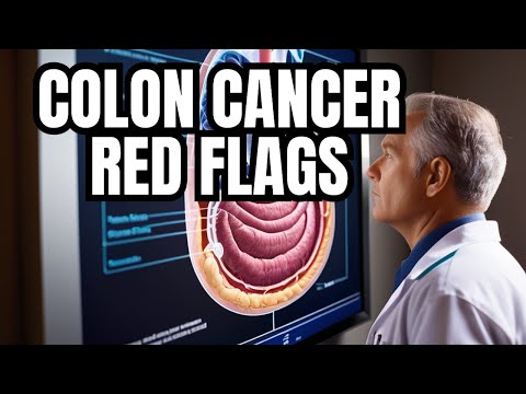 Are you ignoring these 4 warning signs of colon cancer? [Video]