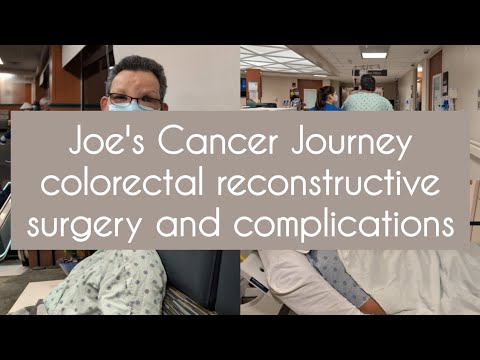 Joe’s Cancer Journey| Colorectal Reconstructive Surgery and Complications [Video]