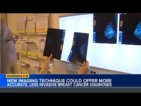 Researchers use new imaging technique for breast cancer screening [Video]