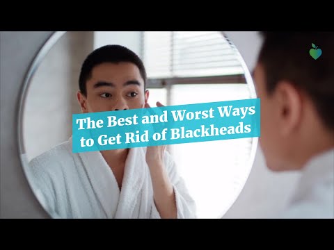 How to Get Rid of Blackheads [Video]