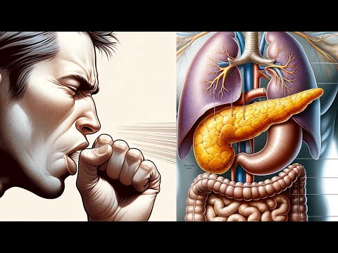 8 Symptoms Of Pancreatic Cancer That You Should Not Ignore. [Video]