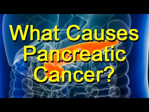 What Causes Pancreatic Cancer? Who’s Most Likely To Get It? [Video]