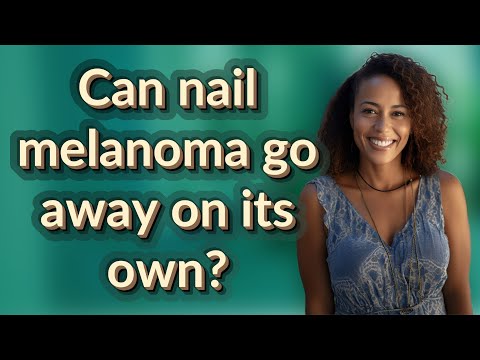 Can nail melanoma go away on its own? [Video]