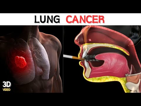 Lung Cancer | Animated Video | Learn Biology With Musawir