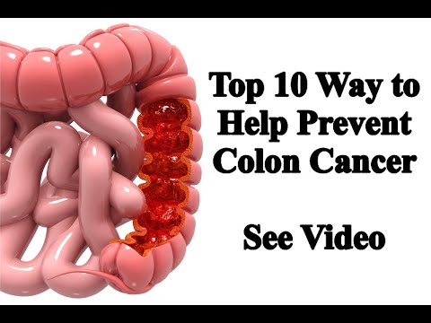 Top 10 Ways to Help Prevent Colon Cancer [Video]
