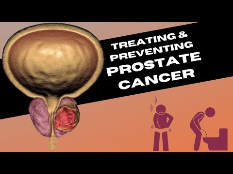 The Treatment Options for Prostate Cancer & Prevention Tips [Video]