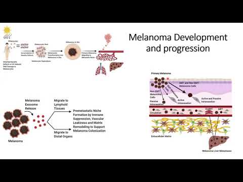 Skin Cancer (Melanoma Development and Metastasis) #Code: 441 [Video]