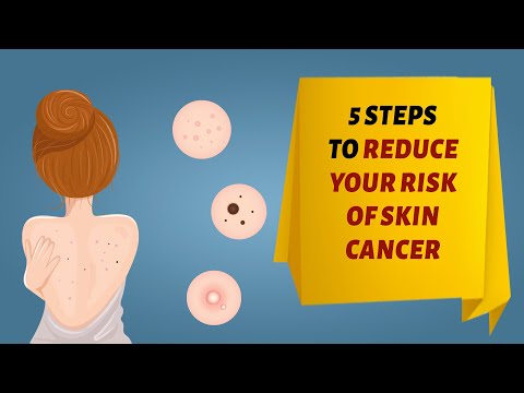 5 Steps to Reduce Your Risk of Skin Cancer [Video]
