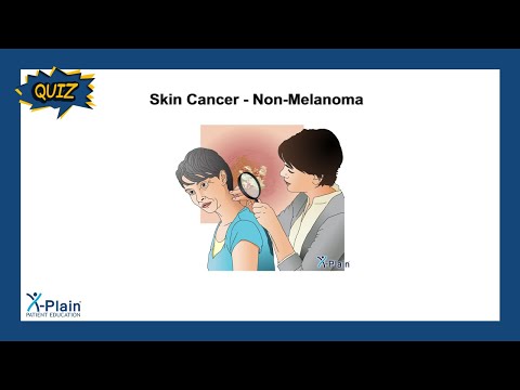 Skin Cancer – Non-Melanoma – Quiz [Video]