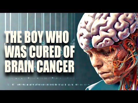 Breakthrough in brain cancer treatment: Lucas’ remarkable recovery | Human Health [Video]