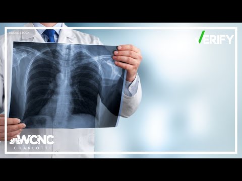 Research shows lung cancer is more common in women | VERIFY Fact Check [Video]