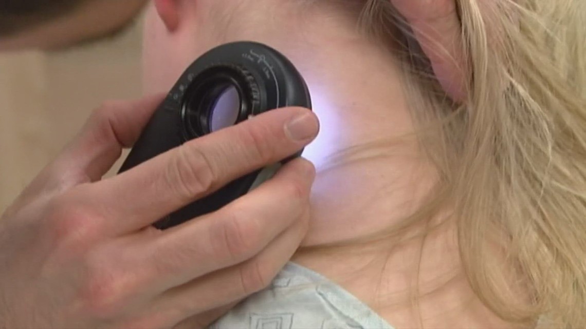 FDA approves first cellular therapy with certain types of melanoma skin cancer [Video]