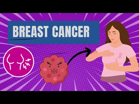 Understanding Breast Cancer: Signs, Symptoms, Diagnosis, and Treatment Explained [Video]