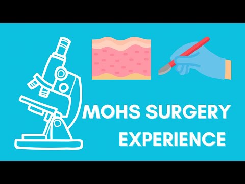Mohs Surgery for Basal Cell Carcinoma Skin Cancer [Video]