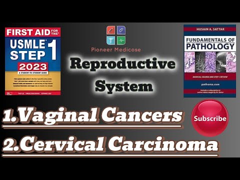 Usmle step 1|Vaginal tumors,Cervical carcinoma from Pathoma|Reproductive system pathology|Urdu/Hindi [Video]