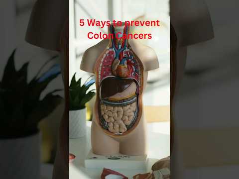 5 Preventable CAUSES of COLON CANCER [Video]