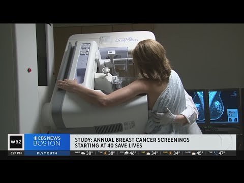 More evidence shows annual mammogram beginning at age 40 could save lives [Video]
