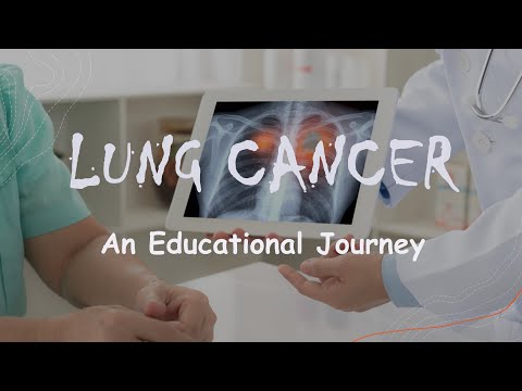 LUNG CANCER: An Educational Journey      [Video]