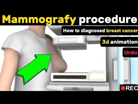 mammogram| mammography| mammography test| mammogram breast exam| @nucleusmedicalmedia [Video]
