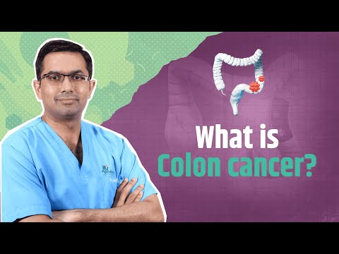What is colon cancer? [Video]