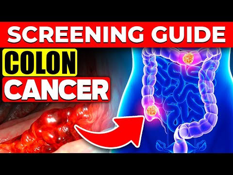 When and how should you be screened for colon cancer? [Video]