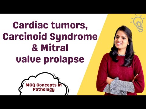 Cardiac tumors, Carcinoid Syndrome & Mitral valve prolapse – MCQ concepts [Video]