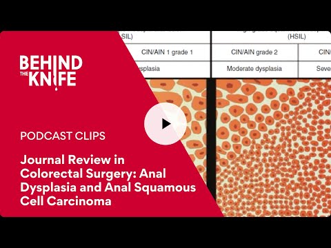 Journal Review in Colorectal Surgery: Anal Dysplasia and Anal Squamous Cell Carcinoma [Video]
