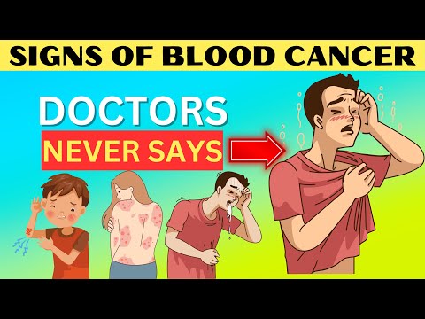 Early signs of Blood Cancer (Doctors Never Say These Symptoms Of Blood Cancer) [Video]