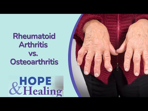 Rheumatoid Arthritis vs. Osteoarthritis | Treating Hand Pain Town Hall [Video]