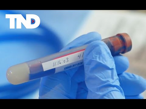 No colonoscopy? Less invasive blood test to revolutionize colorectal cancer screenings [Video]