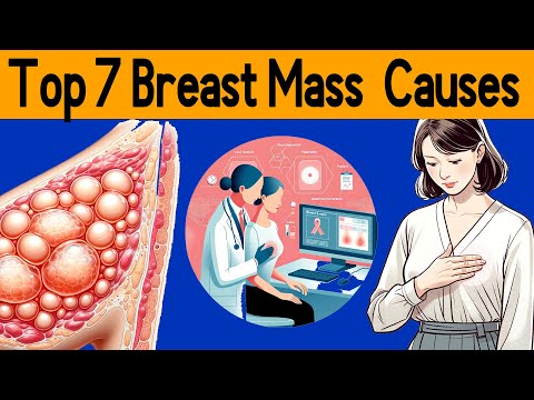 Lumps and Bumps in the Breast: top 7 Causes [Video]