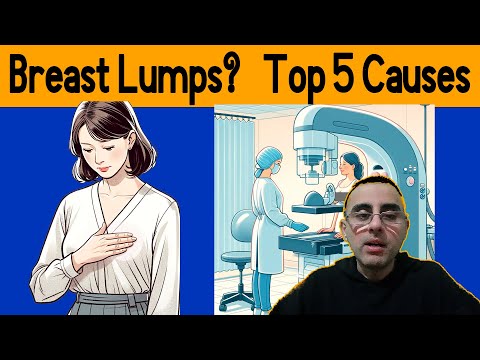 Breast Lumps and Bumps:  Top 5 Causes [Video]