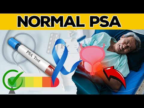 DO YOU KNOW What PSA is Normal for Man Without Prostate Cancer? Let’s Explore | Health Journey [Video]