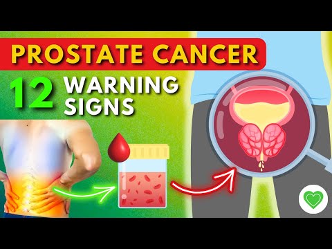 12 Warning Signs Of Prostate Cancer You Should Not Ignore [Video]