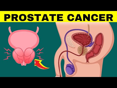 7 Warning Signs of Prostate Cancer [Video]