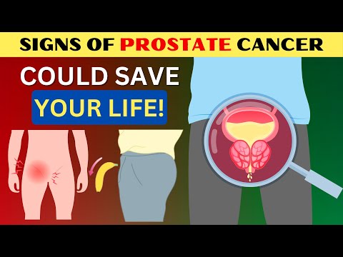 Early Signs Of Prostate Cancer (DON’T IGNORE) [Video]