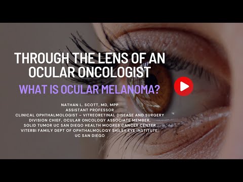 Through The Lens Of An Ocular Oncologist: What is Ocular Melanoma? [Video]