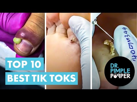 Dr Pimple Popper’s Top 10 Best TikToks! [Video]