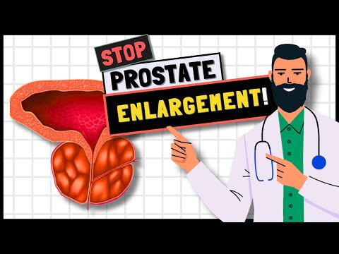 How To Prevent Prostate Enlargement? [Video]