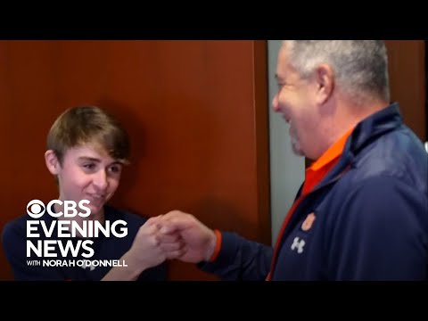 How a student’s friendship with Auburn coach Bruce Pearl gave him the strength to beat leukemia [Video]