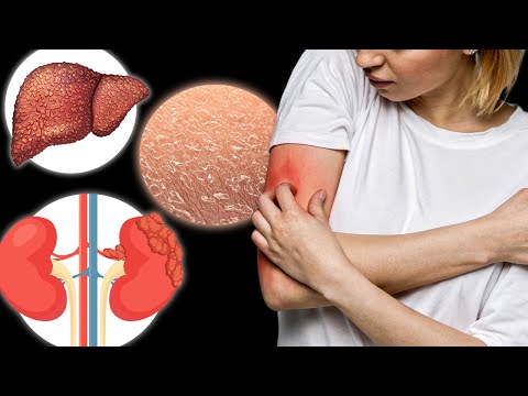 The 15 Causes of ITCHING You’ve Never Heard About [Video]